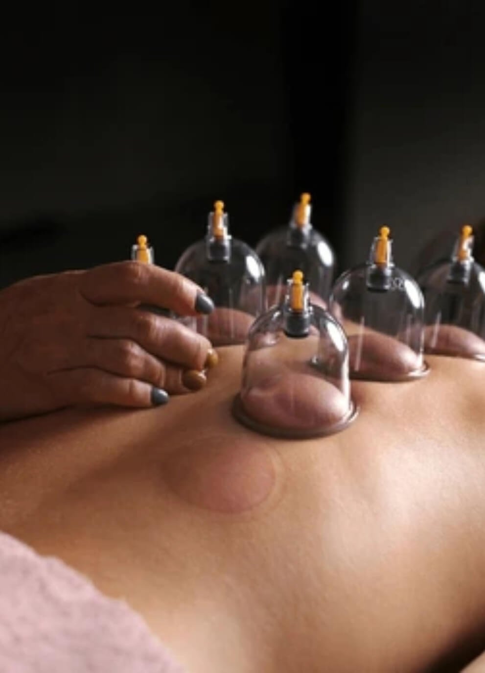 Cupping-massage https://zynk.ae/wp-content/uploads/2025/04/Cupping-massage.jpg